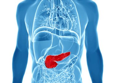 Două noi simptome pentru cancerul pancreatic