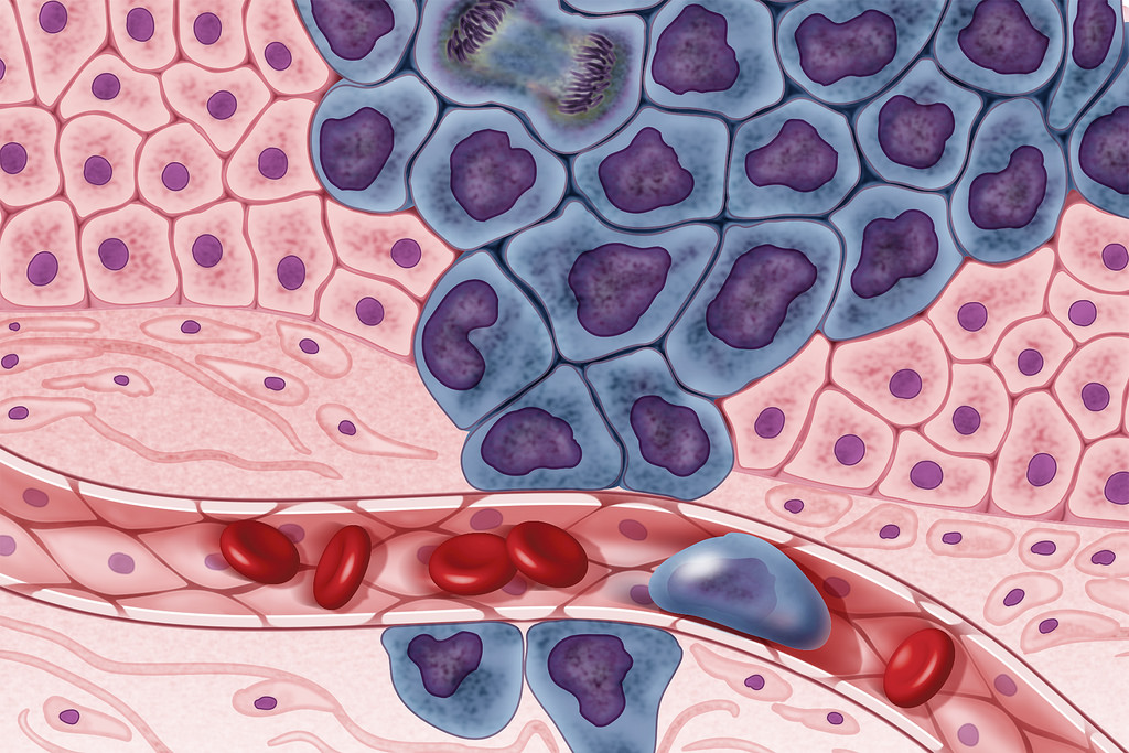 Cancerul şi infarctul miocardic ar putea fi diagnosticate mai uşor cu ajutorul unui test rapid de sânge