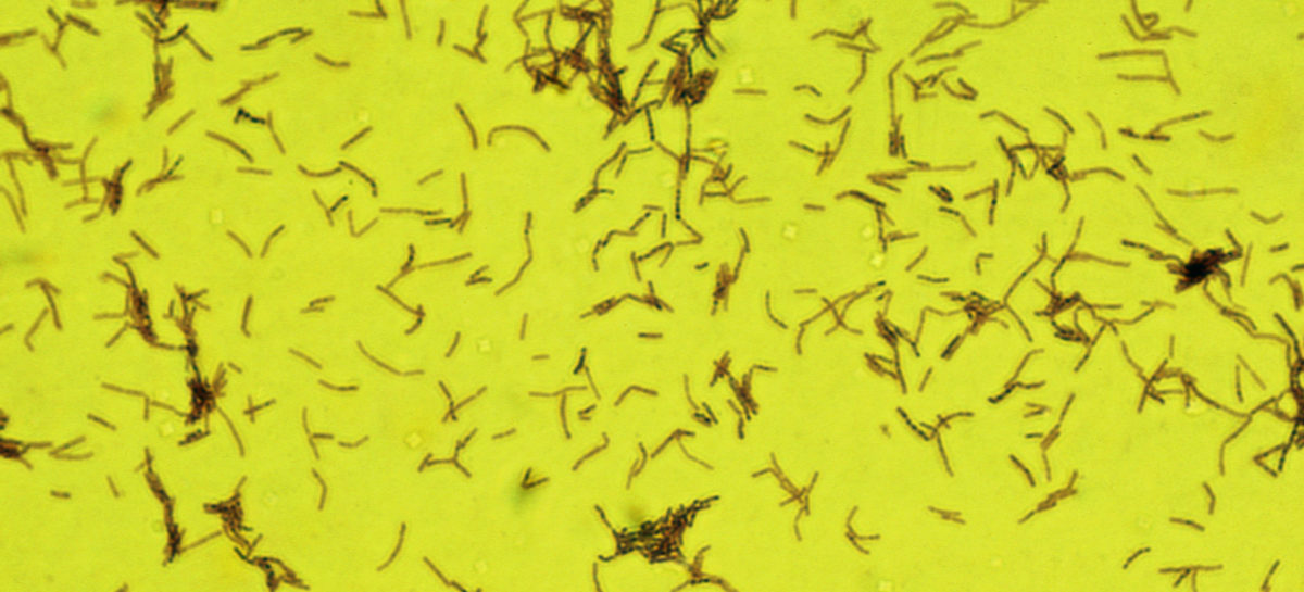 Probiotic Probioticele ar putea distruge bacteriile rezistente la antibiotice, arată un studiu realizat de cercetători americani