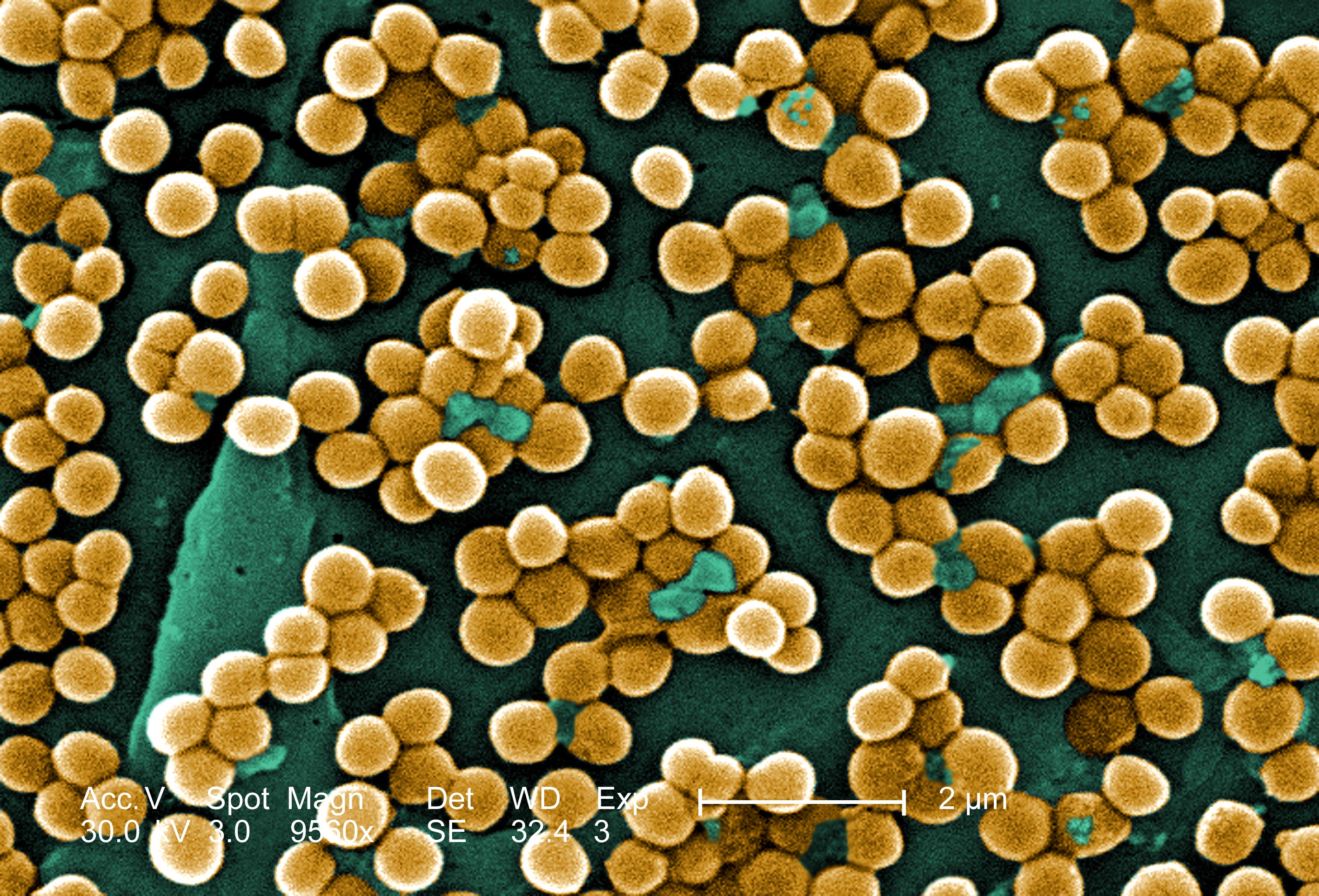 Un nou antibiotic pentru tratarea infecţiilor pulmonare, dezvoltat în Japonia