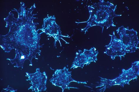 Capacitatea de adaptare la mediu a celulelor stem canceroase poate influenţa negativ eficienţa tratamentelor