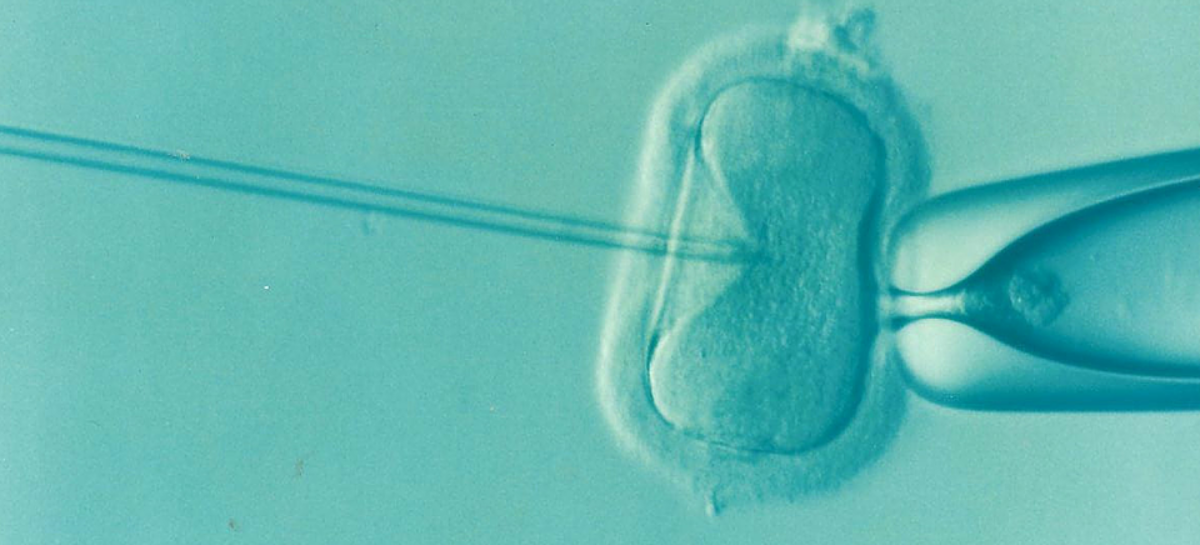 Tratamentul pentru infertilitate masculină, asociat cu un risc mai mare de cancer de prostată
