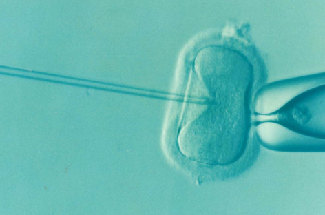 Subprogramul de fertilizare in vitro din România va fi reorganizat în acest an şi va deconta mai multe proceduri