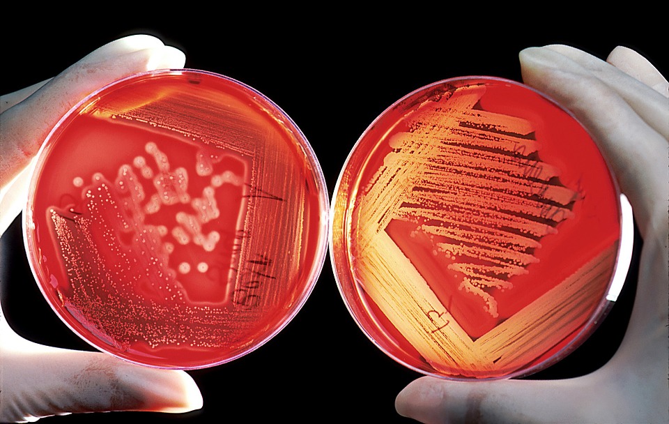 Primul vaccin gripal tetravalent din culturi celulare a fost apropat în UE