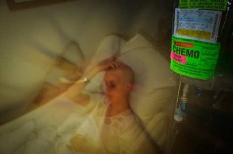 Un dispozitiv absobant poate reduce efectele secundare ale chimioterapiei