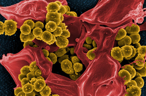 Modul de interacțiune a bacteriilor ce cauzează infecții severe pacienților cu fibroză chistică, identificat de cercetătorii americani
