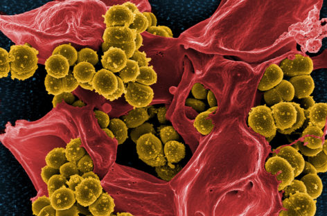 Modul de interacţiune a bacteriilor ce cauzează infecţii severe pacienţilor cu fibroză chistică, identificat de cercetătorii americani