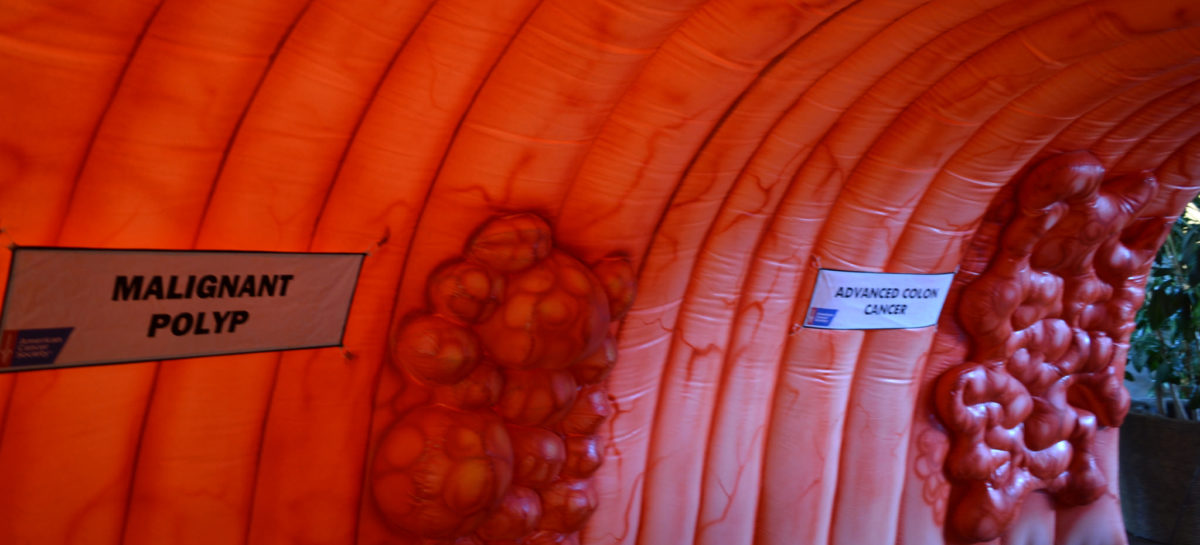 Bacteriile intestinale ar putea fi un indicator al riscului de cancer de colon