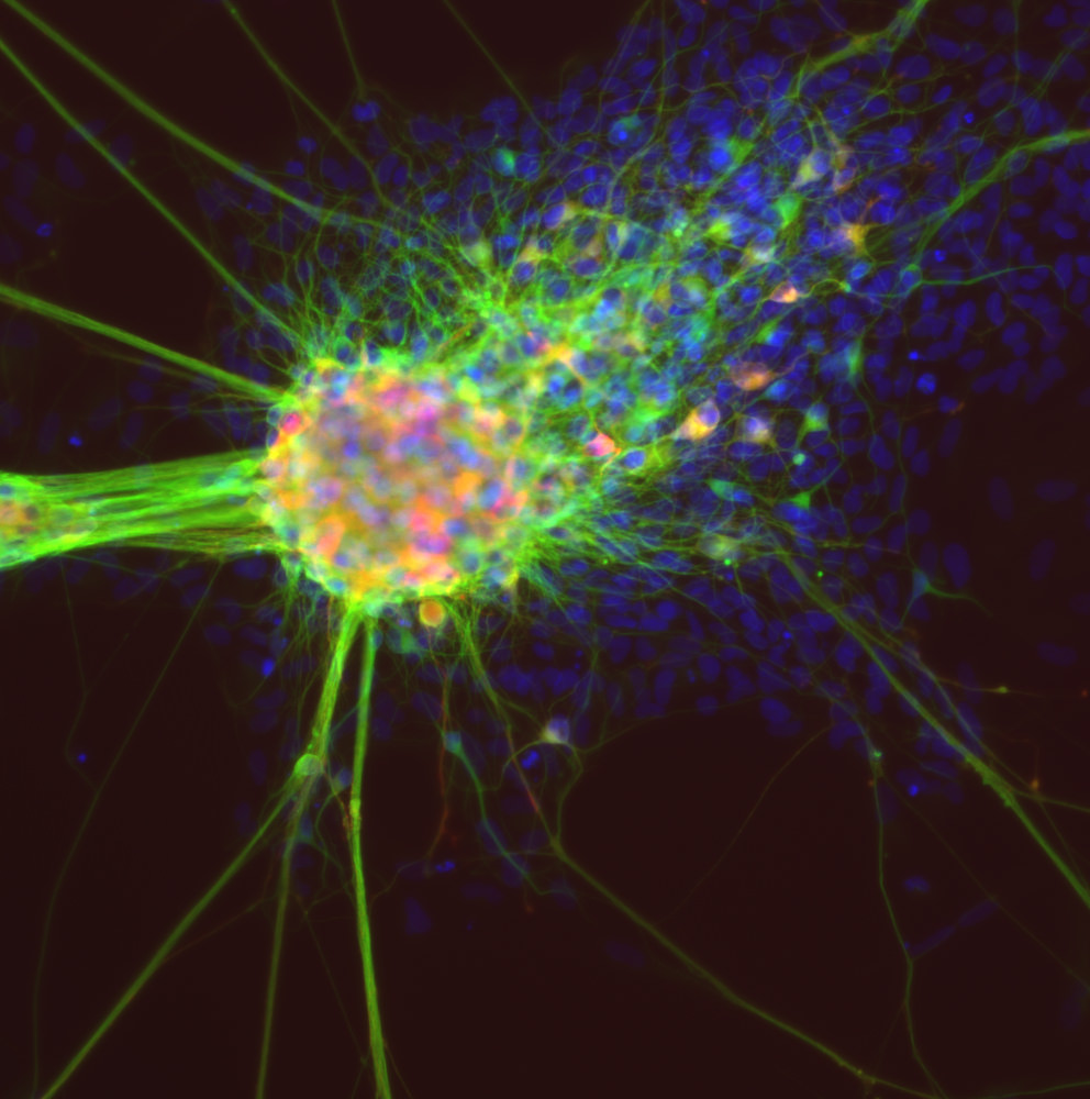 O echipă de cercetători din SUA a descoperit originea celulelor crestei neuronale, ce ar putea genera noi terapii cu celule stem regenerative