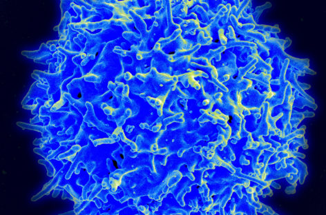 Celulele T, o opțiune promițătoare în imunoterapia pentru boala Crohn