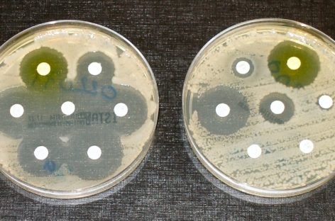 Un nou antibiotic ce conţine arsenic este considerat eficient împotriva bacteriilor rezistente la medicamente