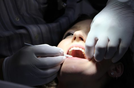 10 motive pentru profilaxia dentară periodică