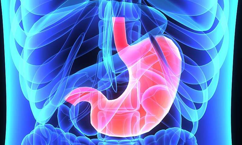 Embolizarea arterială bariatrică este eficientă în tratarea obezităţii, arată un studiu realizat în SUA