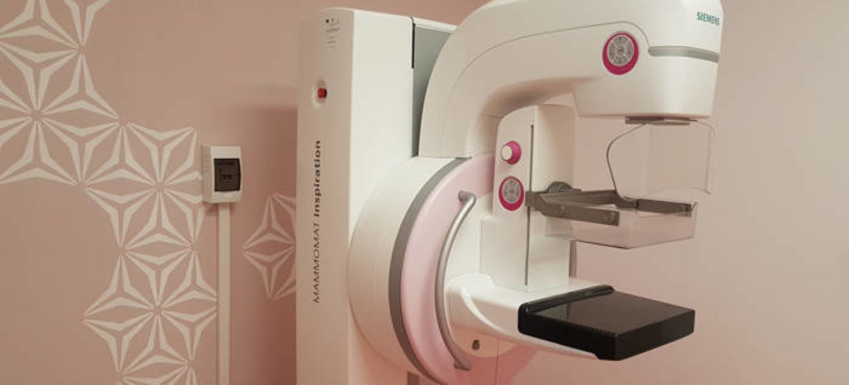 Mamografia digitală cu tomosinteză