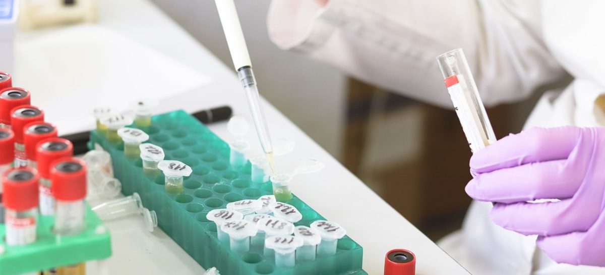 Testare Pandemia de COVID-19 responsabilă de scăderea testării pentru hepatita C