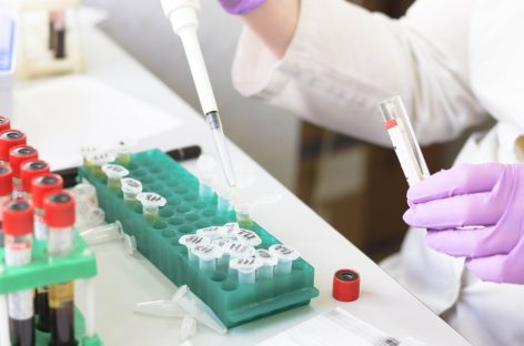 Testul de laborator pentru depistarea anticorpilor Covid-19, certificat CE, disponibil în România