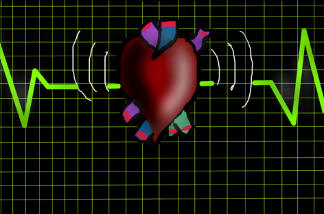 Inteligenţa artificială calculează mai bine scorul de calciu coronarian, identificând mai devreme riscul cardiovascular