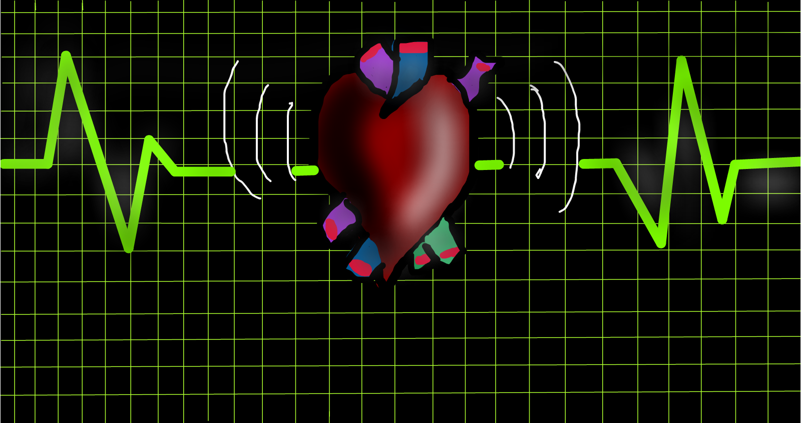 Simptomele de insomnie, asociate cu un risc crescut de accident vascular cerebral şi infarct miocardic