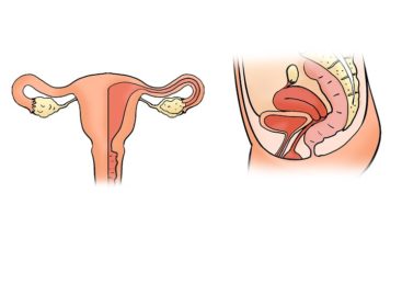 Fibromul uterin: aprope jumătate din cazuri sunt asimptomatice