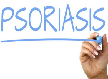 Nivelurile serice ale ustekinumab ar putea ajuta la prezicerea răspunsului la tratamentul pentru psoriazis