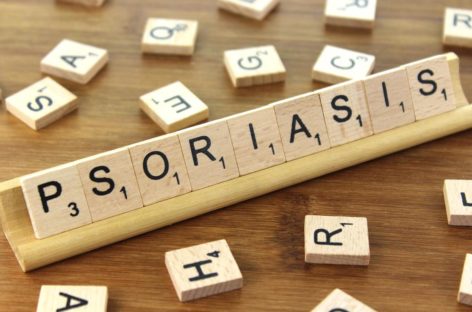 Asociere bidirecţională între psoriazis şi boala inflamatorie intestinală