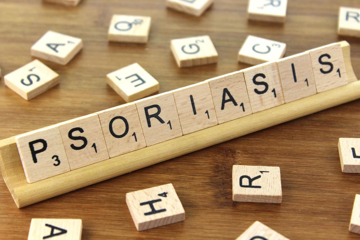 Asociere bidirecţională între psoriazis şi boala inflamatorie intestinală