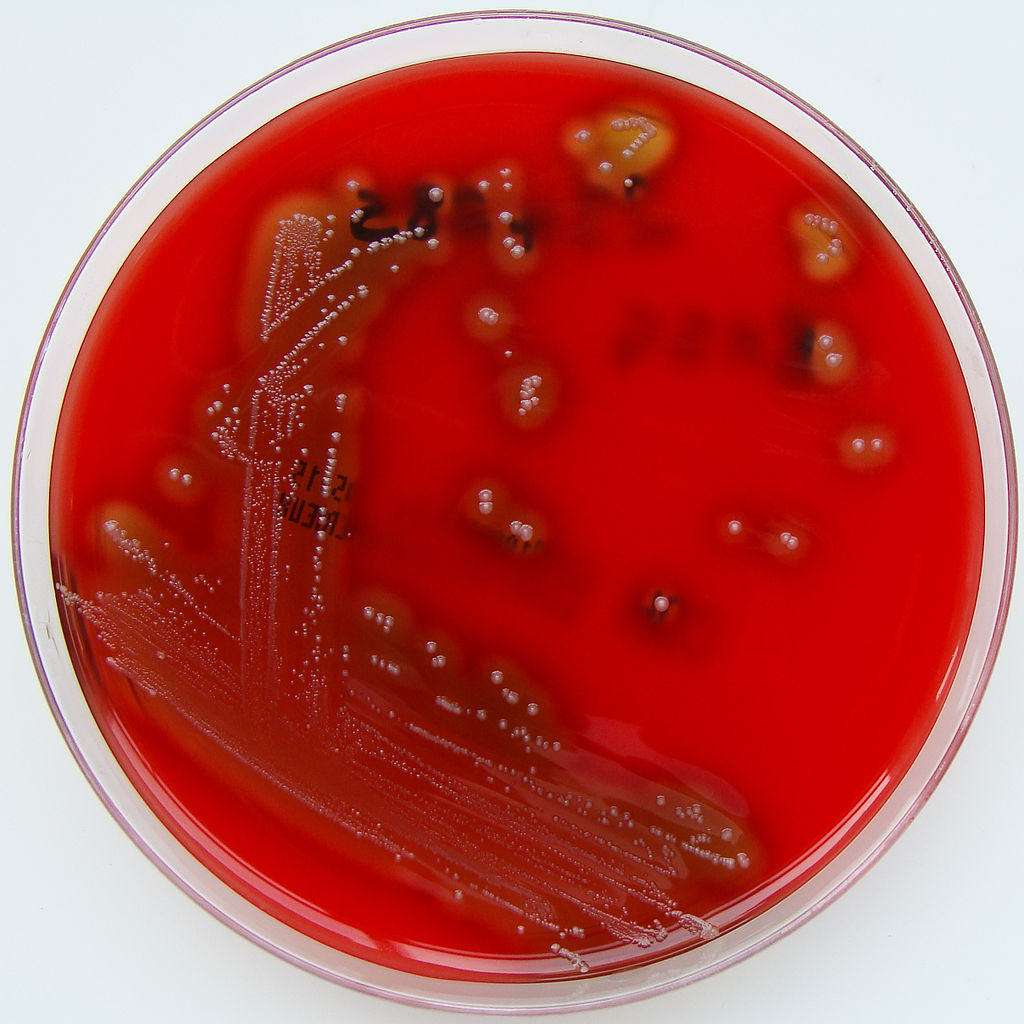 O nouă modalitate de prevenire a infecţiilor streptococice, identificată de cercetători scoţieni