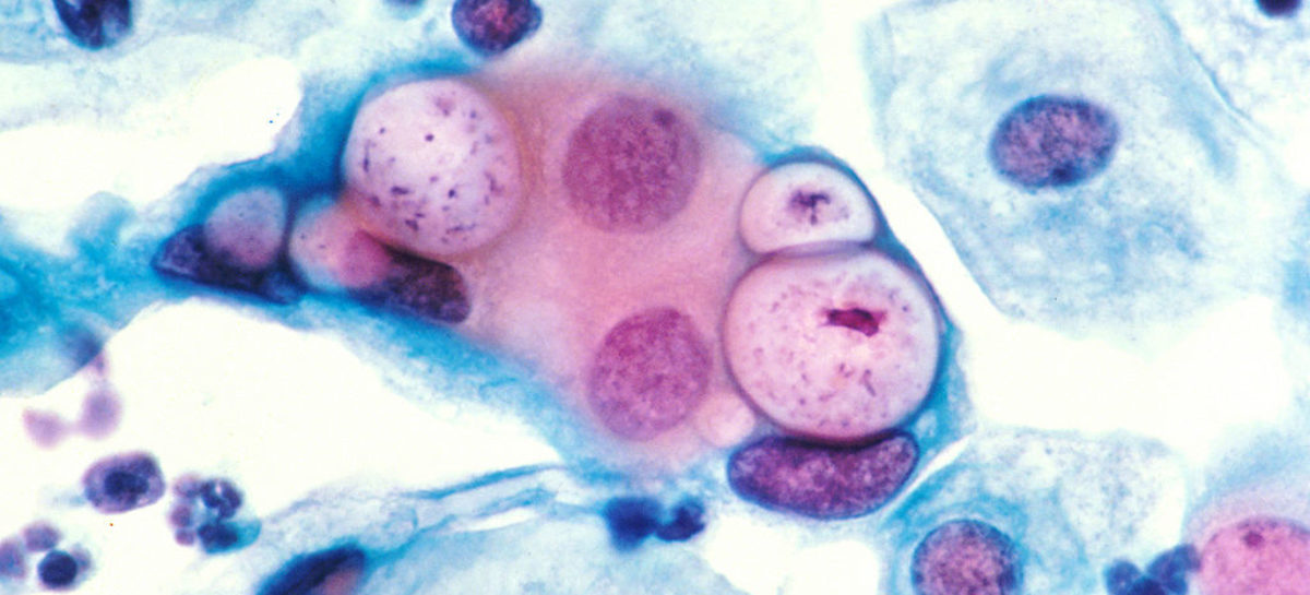 clamydia Modalitatea prin care chlamydia preia ADN-ul gazdei pentru a se răspândi identificată de cercetătorii americani