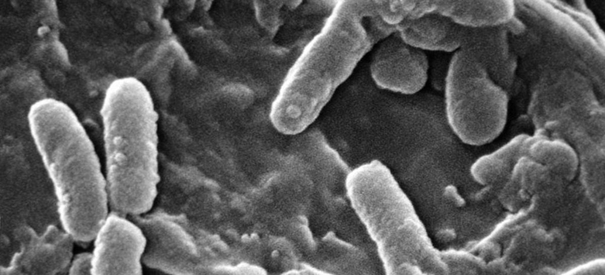 pneumonie nosocomiala Pseudomonas_aeruginosa Un nou antimicrobian dual a obținut rezultate pozitive în tratamentul pneumoniei nosocomiale într-un studiu clinic
