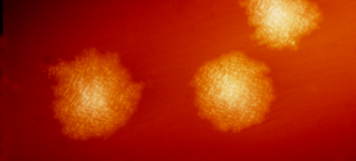 Clostridium difficile Studiu: Bacteria Clostridioides difficile nu poate fi distrusă de niciun dezinfectant folosit în prezent în spitale