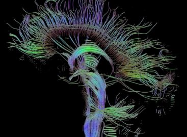 Modul de organizare a rețelelor cerebrale în timpul sarcinii, identificat de cercetătorii olandezi