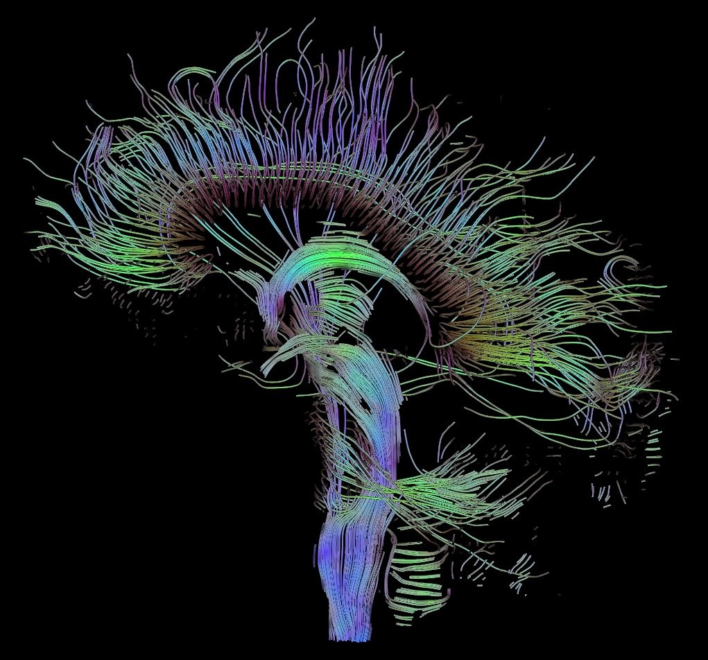 Modul de organizare a reţelelor cerebrale în timpul sarcinii, identificat de cercetătorii olandezi