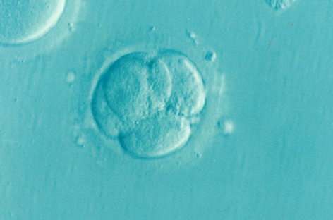 Prezervarea fertilității pentru pacienții oncologici