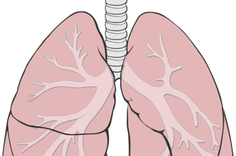 Hipertensiunea arterială pulmonară, o boală subdiagnosticată