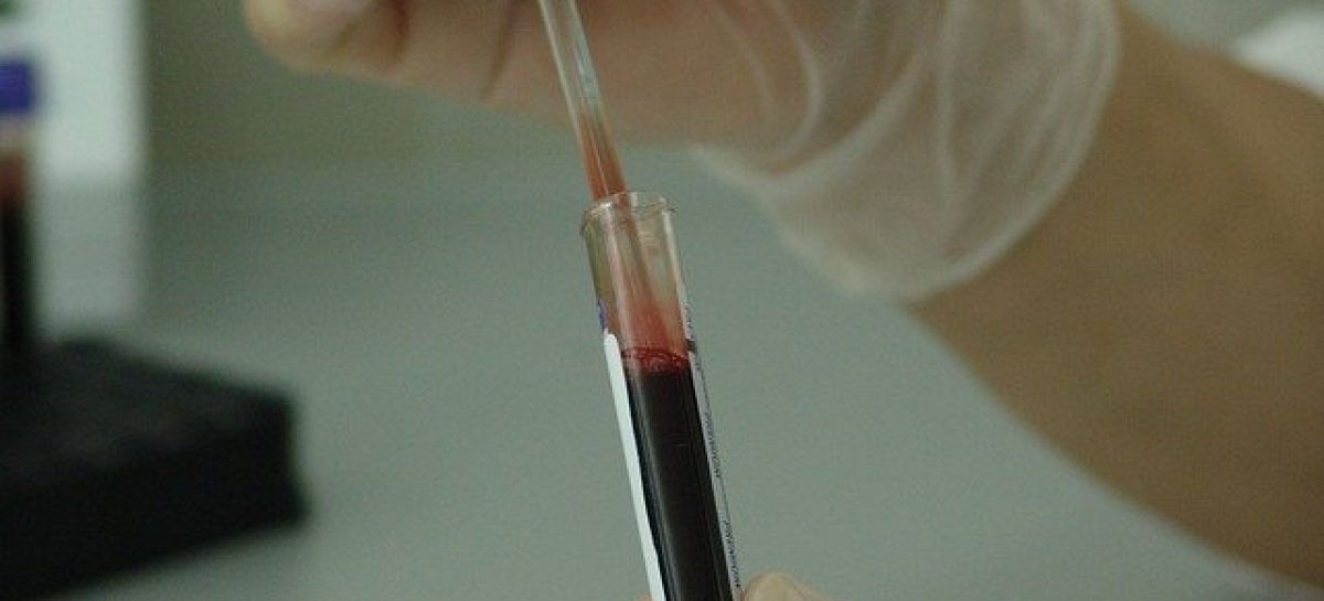 plasma imunoglobuline derivate sange Coronavirusul din China afectează sau nu medicamentele derivate din plasmă la nivelul României? Opinii pro și contra