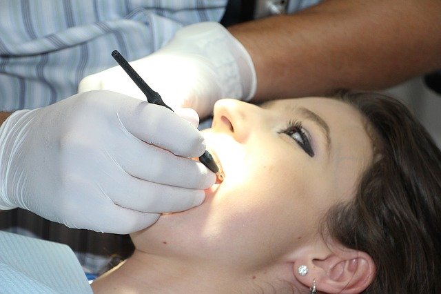 Studiu: Un nou instrument dentar poate depista aciditatea la nivelul dinţilor care duce la apariţia cariilor