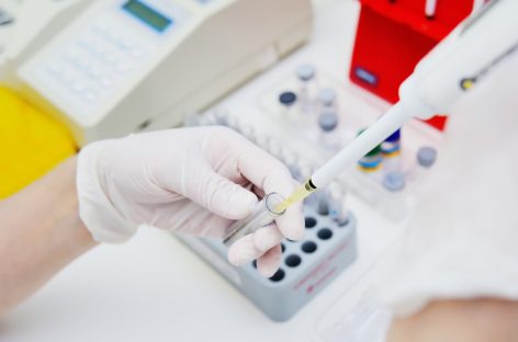 FDA emite prima autorizație de urgență pentru un test folosit în testarea cumulată a probelor