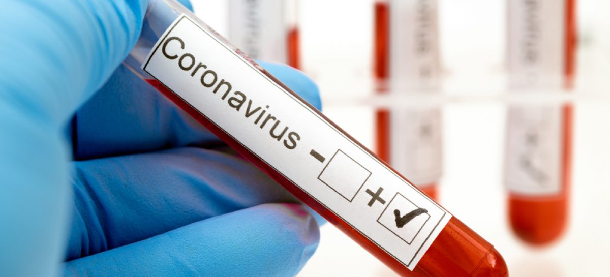 Ministerul Sănătății a introdus testarea pentru noul coronavirus în programul național de boli transmisibile; testul RT-PCR, decontat cu 200 lei