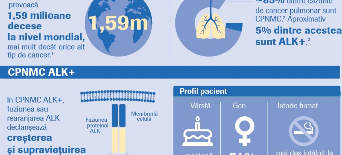 Cancer pulmonar O nouă terapie țintită disponibilă pentru pacienții cu o formă rară de cancer pulmonar