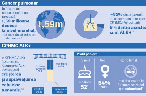 O nouă terapie ţintită disponibilă pentru pacienţii cu o formă rară de cancer pulmonar