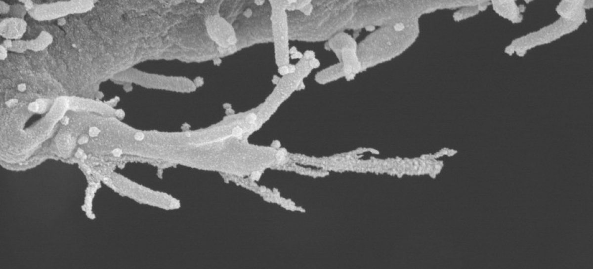 Mecanism infecție SARS-CoV-2 Nou mecanism prin care virusul SARS-CoV-2 infectează celulele umane, identificat de cercetători