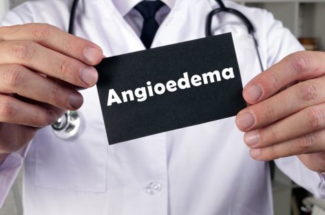 Persoanele care suferă de angioedem ereditar sunt de 3 ori mai predispuse la depresie și de 10 ori mai predispuse la anxietate