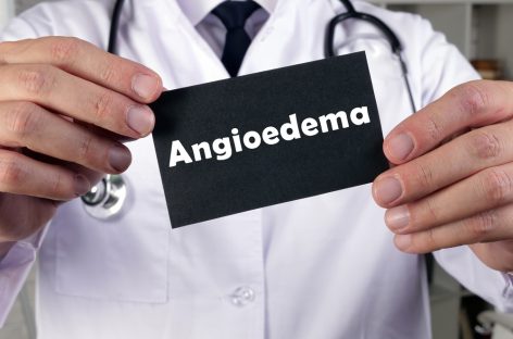 Dr. Noemi Bara, despre diagnosticul în angioedemul ereditar: De un an şi jumătate derulăm un proiect prin care analizele pot fi efectuate gratuit şi am reuşit să confirmăm diagnosticul la 25 de pacienţi