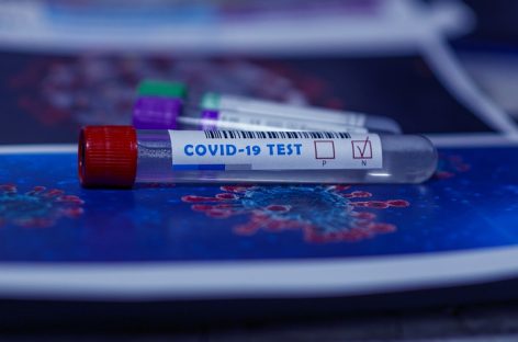 Nivelurile de anticorpi specifici SARS-CoV-2 sunt de 3 ori mai mari după vaccinare decât după infecţie