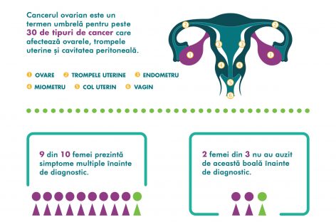 Cancerul ovarian poate avea o supravieţuire de până la 94%