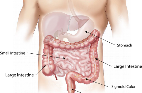 Medicii americani recomandă scăderea vârstei la care începe screeningul cancerului colorectal colonoscopia prin CT