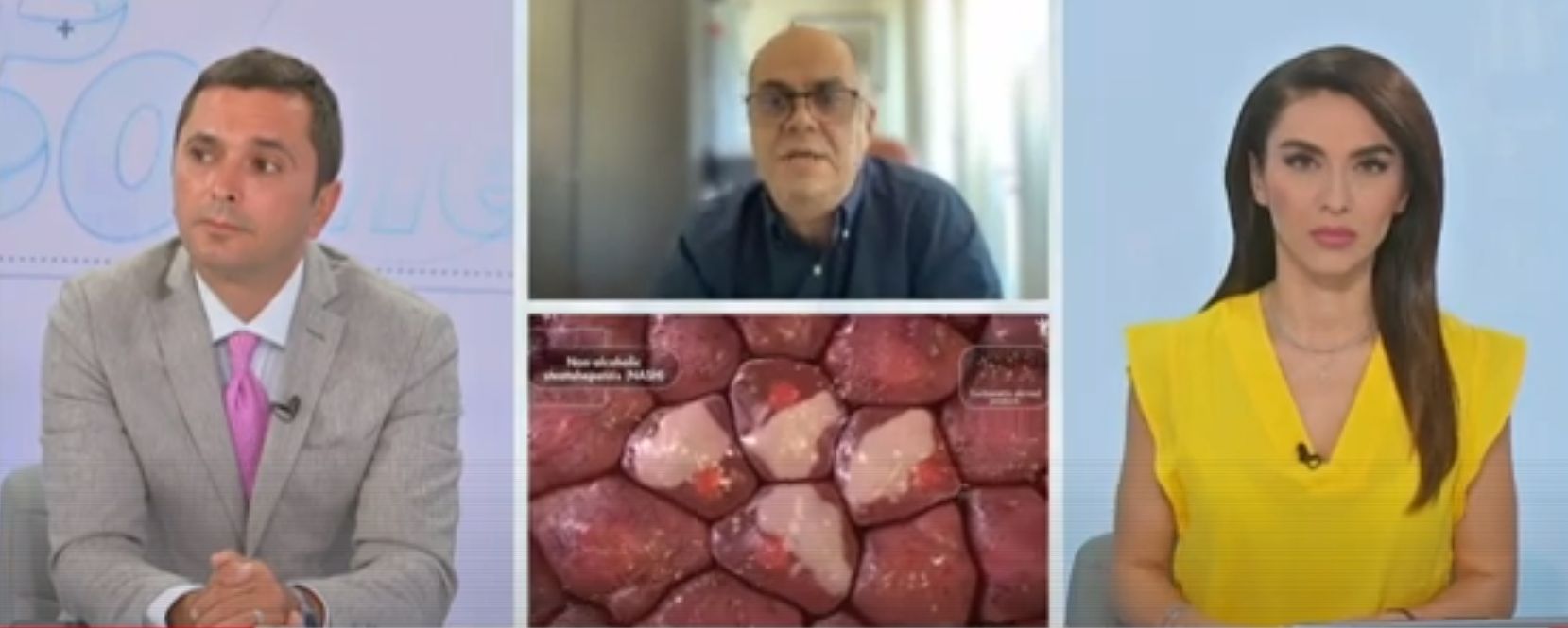 O treime din populaţie suferă de boala ficatului gras. Prevenţie şi tratament în bolile hepatice