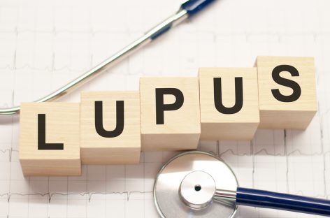 Tratamente pentru lupus, rezultate promiţătoare în studiile clinice