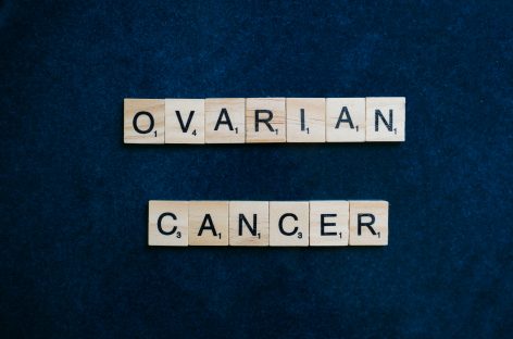 Două gene care protejează cancerul ovarian de răspunsul imun, descoperite de cercetători