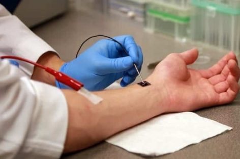 Un nanocip inovator care poate reprograma țesutul biologic ajutând corpul să se vindece a trecut de faza de prototip